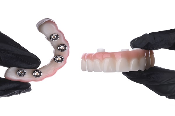 The Advantages Of Implant Supported Dentures Over Regular Ones