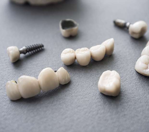Knoxville The Difference Between Dental Implants and Mini Dental Implants
